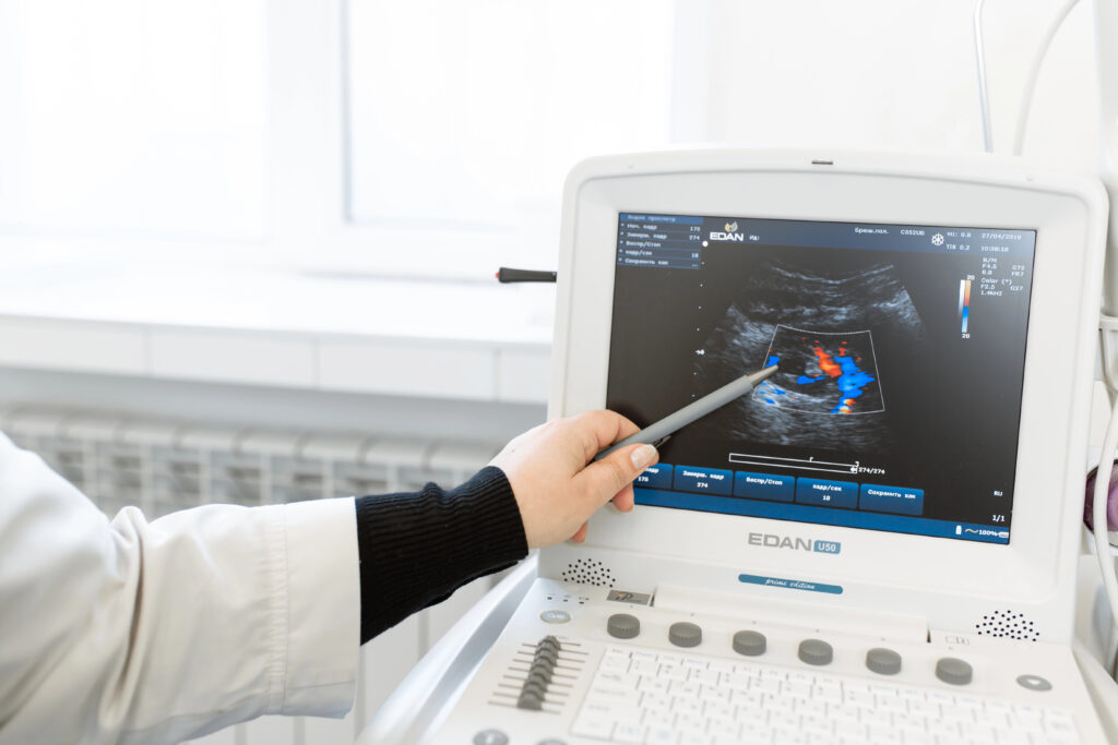 AFE and Pregnancy Risks