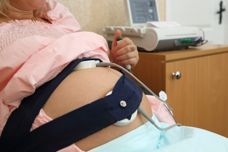 Fetal Heart Rate Monitoring